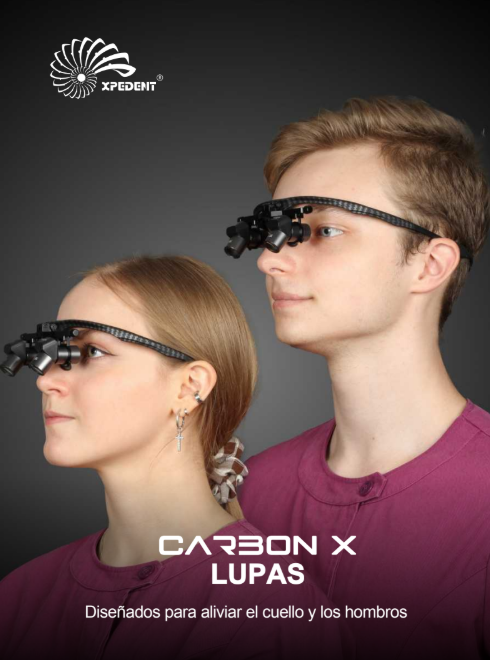 Lupas Carbon Fore XPEDENT